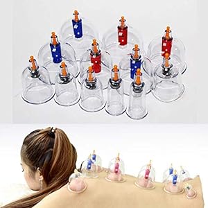 Cupping